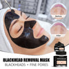 Diep Reinigend Gezichtsmasker (Peel Off charcoal)